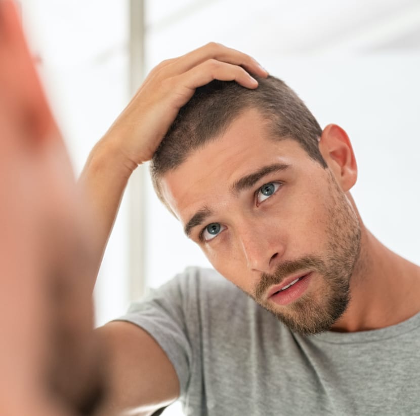 Treatments 8 hairloss-fi